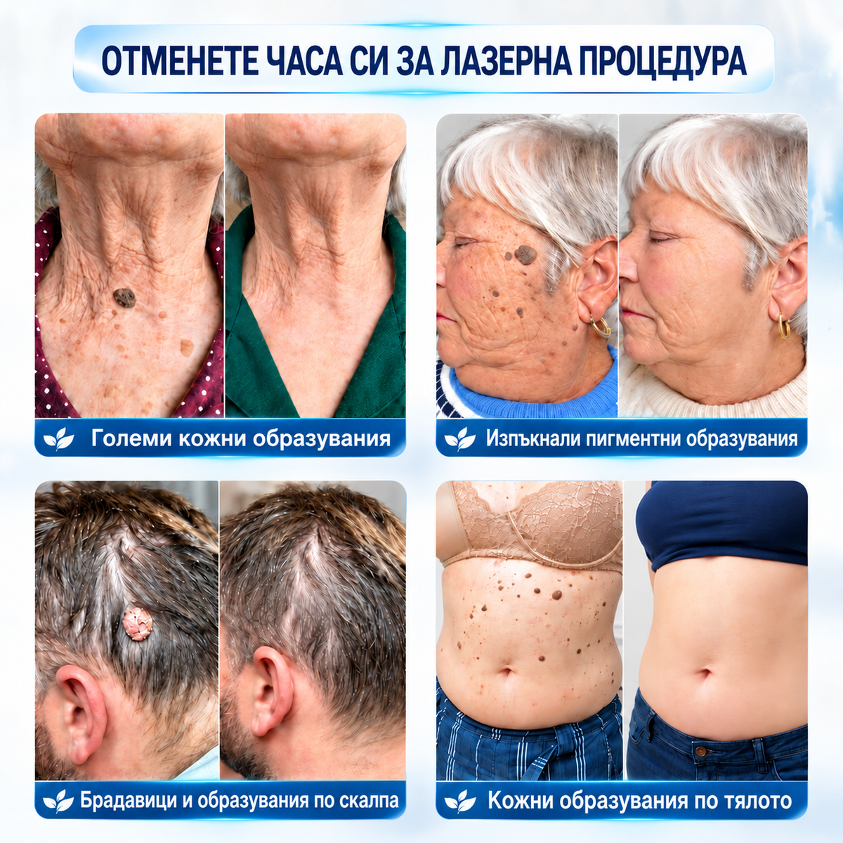 𝐏𝒊𝐜𝐝𝒐®🍒🍒 7-дневна рол-он писалка за премахване на пигментни петна и белези (Без болка, без образуване на нови белези – с ролков апликатор)💪