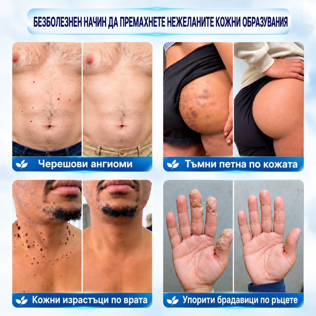 𝐏𝒊𝐜𝐝𝒐®🍒🍒 7-дневна рол-он писалка за премахване на пигментни петна и белези (Без болка, без образуване на нови белези – с ролков апликатор)💪