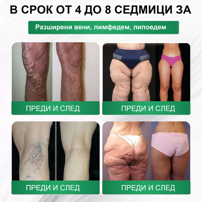 Официален магазин |🍋‍🟩𝑳𝒖𝒙𝒂𝙧𝙞𝙨𝙚® Моринга 𝗫 Берберин 𝟭𝟬-𝗜𝗻-𝟭 Напреднал Нано Микроигли Пластир (Един път на ден, видими промени за 7 дни）✅ Ожиряване, диабет, сънна апнея и проблеми със ставите
